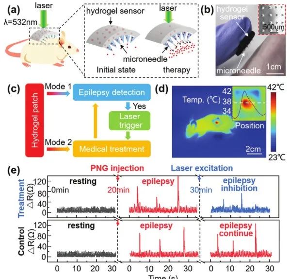 《Adv.Sci.》：可檢測、治療癲癇病的酶降解絲質水凝膠傳感器