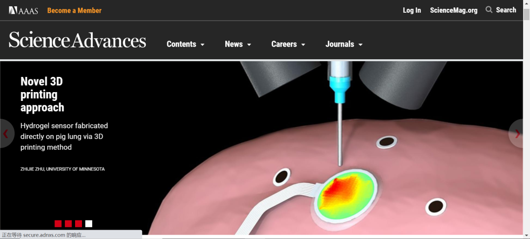 《Science》子刊：在活體器官上原位3D打印可變形水凝膠傳感器！