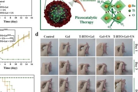施劍林院士、陳雨研究員《先進(jìn)材料》：超聲引發(fā)鈦酸鋇壓電性用于無(wú)創(chuàng)壓電催化腫瘤療法
