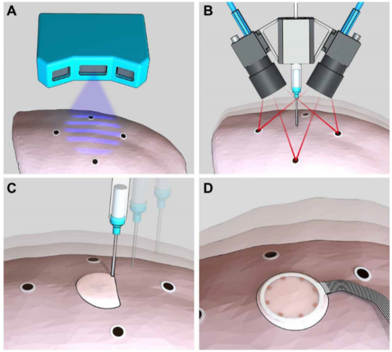 《Science》子刊：在活體器官上原位3D打印可變形水凝膠傳感器！