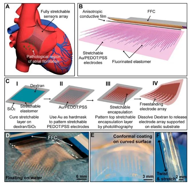 斯坦福大學(xué)鮑哲南團(tuán)隊(duì)：柔性電子新突破！細(xì)胞級(jí)分辨率心電監(jiān)測(cè)，守護(hù)人類健康