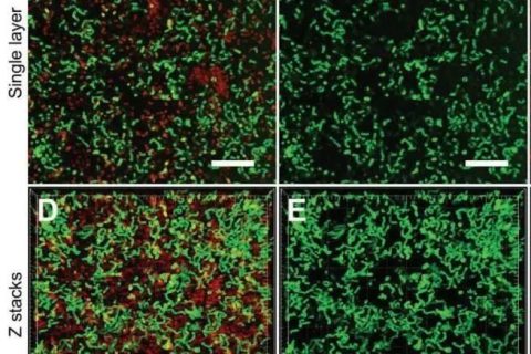 新加坡國立大學(xué)《AFM?》：肉眼可見！共軛低聚電解質(zhì)助力革蘭氏細(xì)菌的區(qū)分